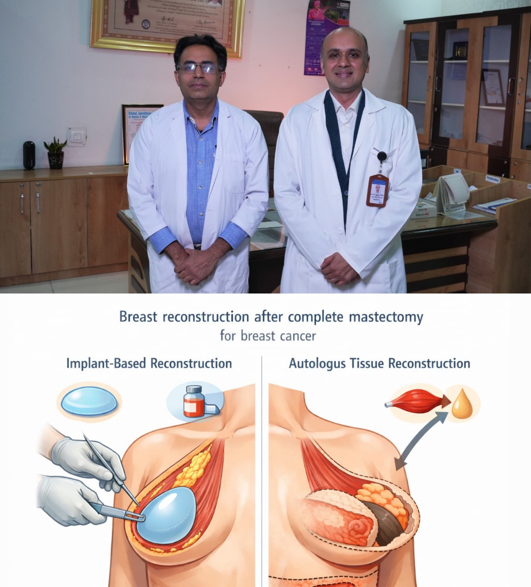 श्री महंत इन्दिरेश अस्पताल में, स्तन कैंसर पीड़ित महिला का पूरा स्तन हटाकर नया स्तन बनाया।