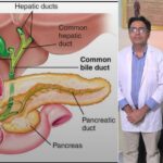 विश्व कैंसर दिवस पर श्री महंत इन्दिरेश अस्पताल ने, चिकित्सा जगत में रचा इतिहास। 