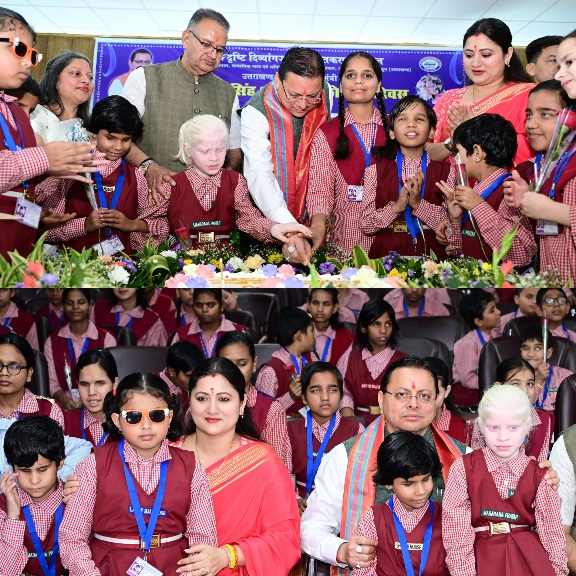 सीएम धामी ने दिव्यांग बच्चों के साथ मनाया अपना जन्मदिन, बच्चों के साथ केक काटकर साझा की खुशियां।